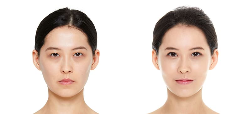 Slider image (3) JK Plastic Surgery Korea Aesthetic Surgery Clinic